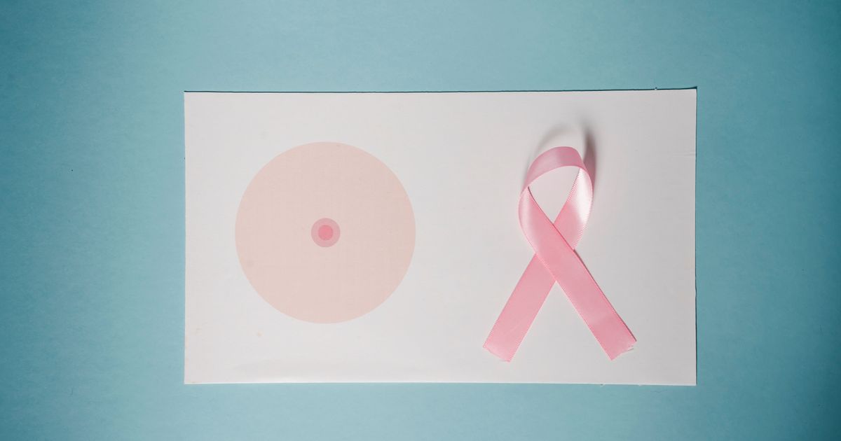 AI w mammografii: które obietnice sprawdzić przed zakupem?

