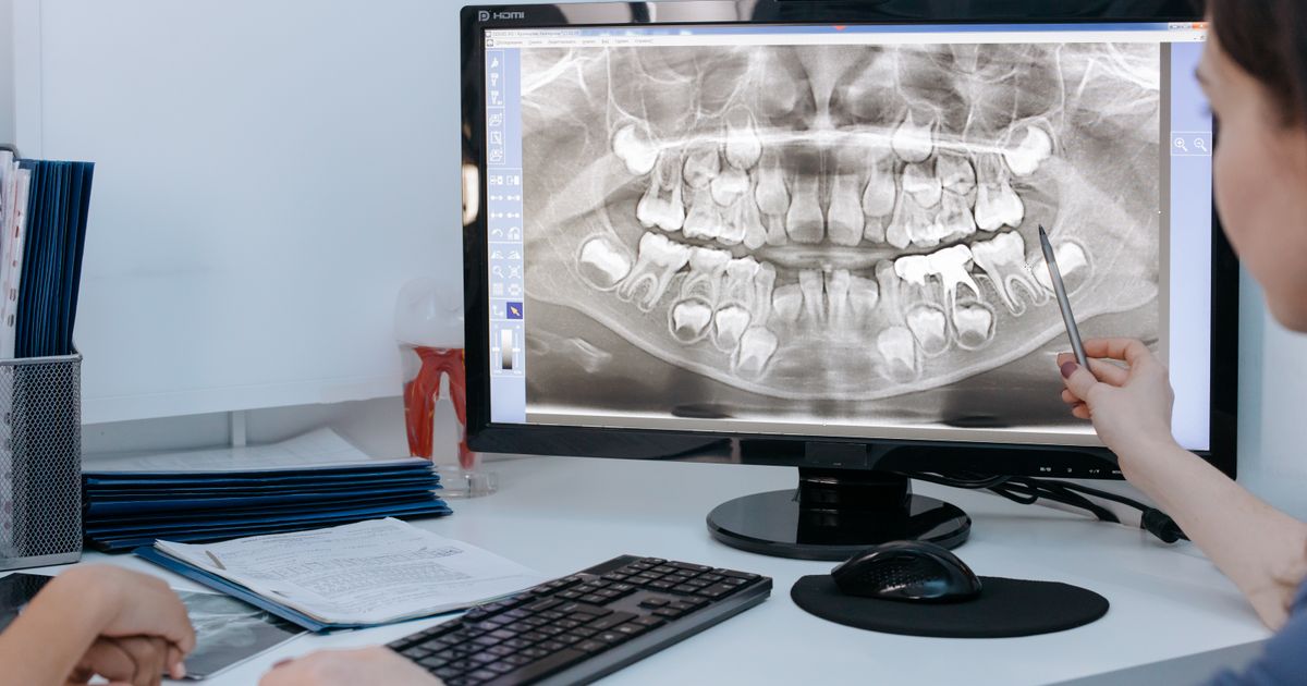 AI w stomatologii: zdjęcia RTG, plan leczenia i komunikacja z pacjentem
